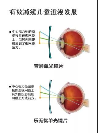 雙11（5）