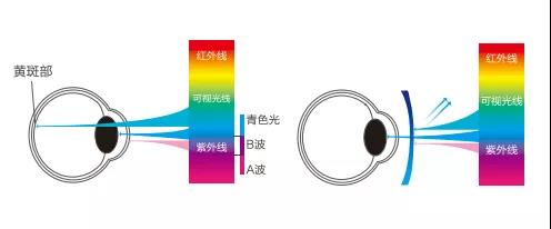 雙11（31）